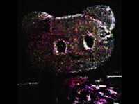 Thumbnail for the 1 800 PAIN - BNE link, provided by host site