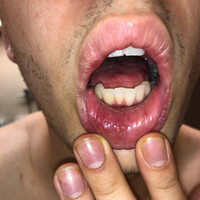 Thumbnail for the Fredo Disco - CANKER SORE 2 link, provided by host site