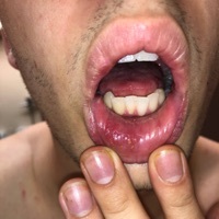 Thumbnail for the Fredo Disco - Canker Sore 2 link, provided by host site