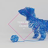Thumbnail for the Tony Arc - Celiaco link, provided by host site