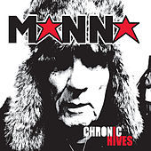 Thumbnail for the Manna - Chronic Hives link, provided by host site