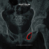 Thumbnail for the Dez - Coxa Valga link, provided by host site