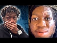 Thumbnail for the OG Maco - Explains His Flesh Eating Disease Situation link, provided by host site