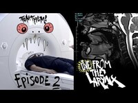 Thumbnail for the Tom Thum - Live from the Larynx EP.2 - Beatboxer vs MRI (Tom Thum) link, provided by host site