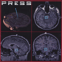 Image of Press linking to their artist page due to link from them being at the top of the main table on this page