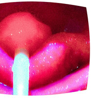 Thumbnail for the Nadir - RED link, provided by host site