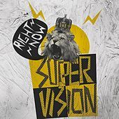 Thumbnail for the Supervision - Right Now link, provided by host site