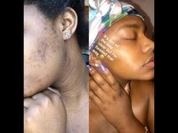 Thumbnail for the Summerella - SKIN CARE ROUTINE !!! link, provided by host site
