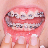 Thumbnail for the horsehead - Teeth link, provided by host site