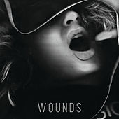 Thumbnail for the Jekyll - Wounds link, provided by host site