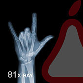 Thumbnail for the George Privatti - X-Ray link, provided by host site