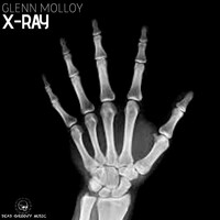 Thumbnail for the Glenn Molloy - X-Ray link, provided by host site