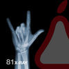 Thumbnail for the Guille Placencia & George Privatti - X-Ray link, provided by host site